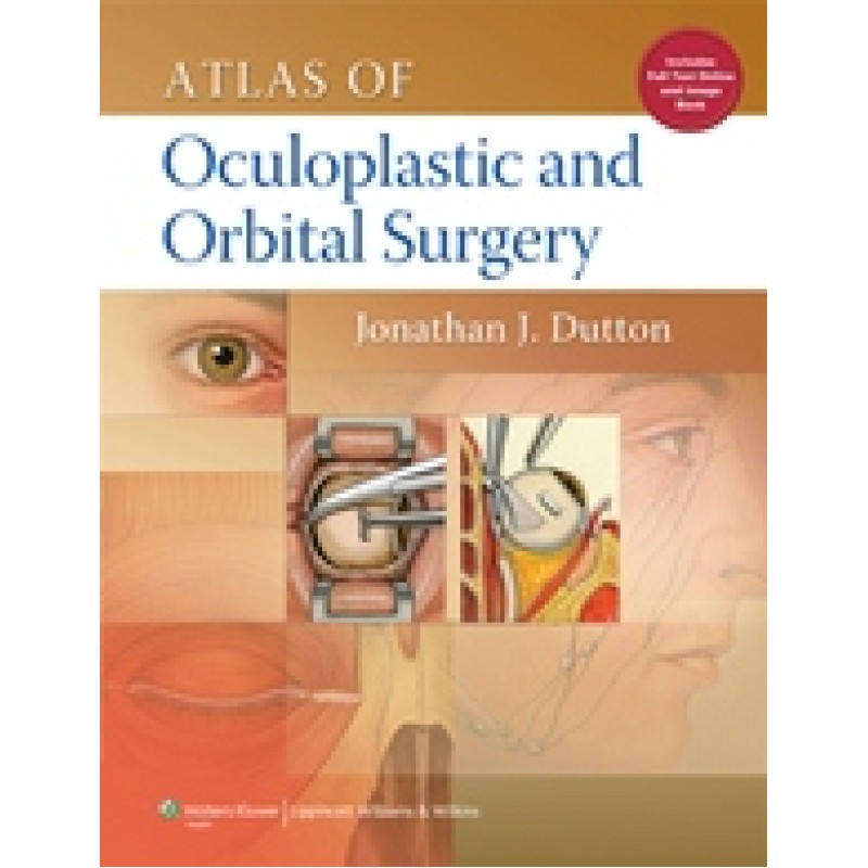 Atlas of Oculoplastic and Orbital Surgery